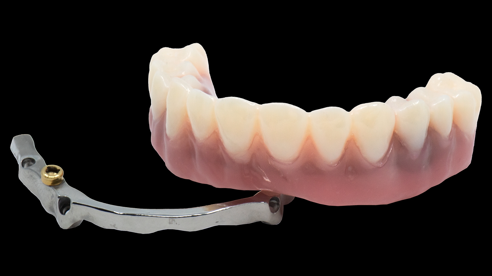 Removable main